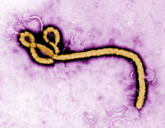 PHOTO: Texas health officials are reassuring residents that they are not at risk of contracting Ebola, unless they had contact with Thomas Duncan, who died on Wednesday at a hospital in Dallas. Photo credit: CDC Global/Flickr.