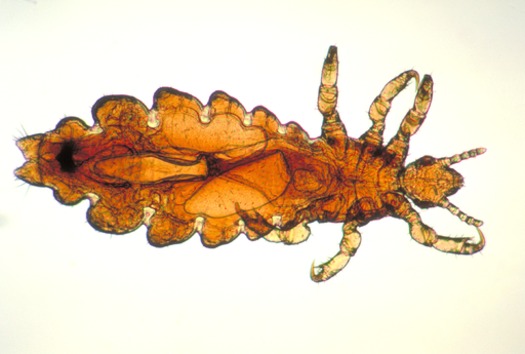 Drug-resistant lice have been found in Michigan and at least 24 other states. Credit: CDC/James Gathany via Wikimedia Commons