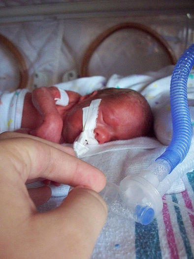 Research from Children's Mercy Hospital in Kanasas City and other facilities holds promise for extreme preterm infants. Credit: Chris Hall/Wikimedia Commons.