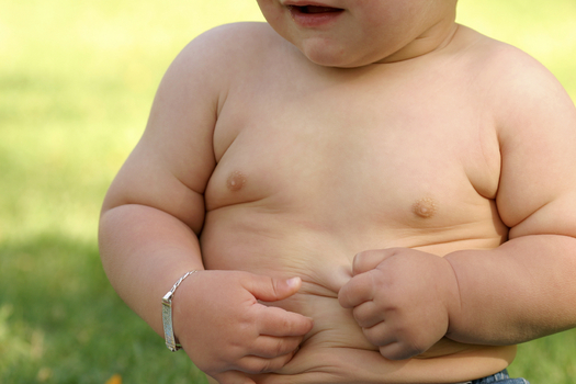 North Dakota health experts warn that, due to a rise in childhood obesity, the next generation could live shorter lives than their parents. (iStockphoto)