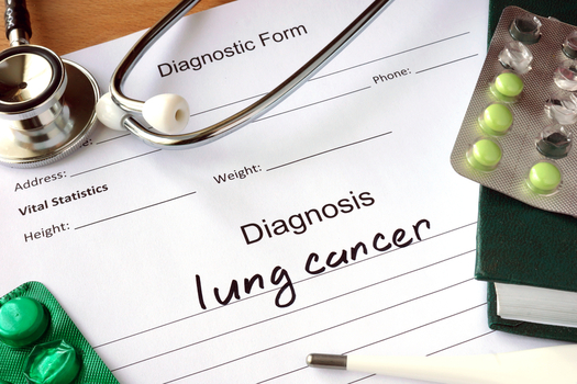 Lung cancer kills more than 400 people every day, according to the American Lung Association. (designer491/iStockPhoto)