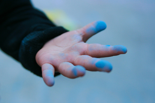 Tennessee is one of five states that doesn't require insurers to cover applied behavior analysis (ABA), a common and proven treatment for autism spectrum disorders. (MamiGibbs/Flickr)