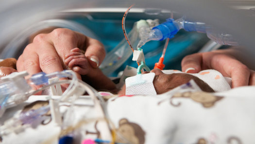 While neonatal intensive care units are common in hospitals, level four NICUs – which provide the most complex care for the tiniest and sickest babies – are designated by region. (Children's Mercy Hospital)