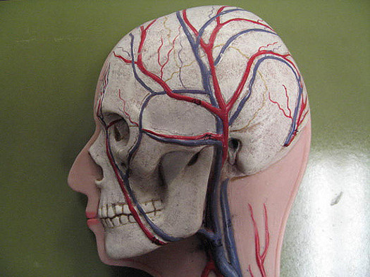 Strokes are among the leading causes of long-term disability in the United States. (GreenFlames09/Flickr)