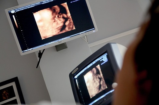 A new law requires the Florida Department of Health to contract with a not-for-profit statewide alliance of organizations to provide pregnancy support and wellness services that are non-coercive and exclude religious content. (Pixabay) 
