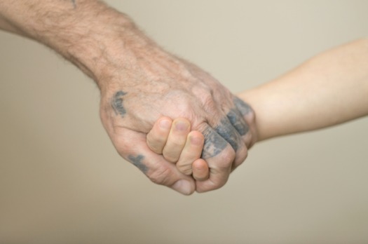 A patient gets his hand tattoo removed. (Adobe Stock)