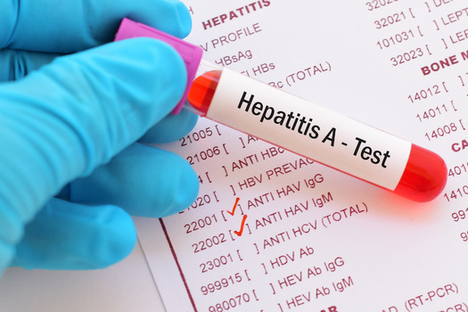 More than 4,000 cases of hepatitis-A have been reported in Kentucky since 2017. (Adobe Stock) 