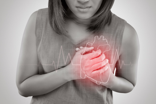 Women are more likely to experience multiple heart-attack symptoms. (Adiano/Adobe Stock)