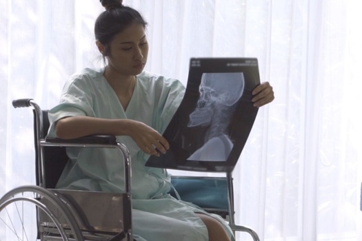 Brain injuries from domestic violence can cause physical and mental issues, including headaches, fatigue, dizziness, depression and anxiety. (Adobe Stock)