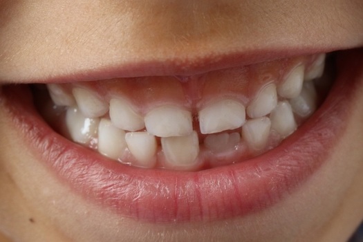 Colorado's dental clinics used a pause in operations to re design spaces and workflows for staff and patient safety, and fast-track tele-dentistry services. (Pxhere)