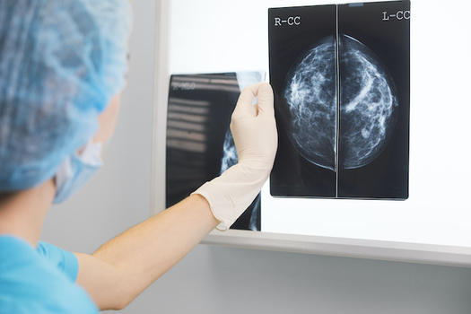 Millions of people have opted to put off their routine cancer screenings out of fear of exposure to COVID-19 at hospitals and doctors' offices. (Adobe Stock)