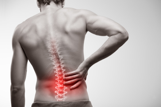 One in four Americans lives with lower back pain, according to the Centers for Disease Control and Prevention. (Adobe Stock)<br />