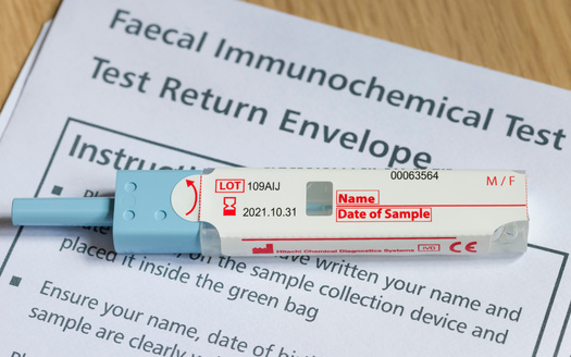 FIT tests to screen for colorectal cancers typically are received and sent through the mail. (Paul Maguire/Adobe Stock)