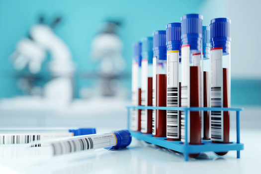 In 2016, the FDA issued a safety warning on risks associated with ovarian cancer screening tests, including false negatives could result in delayed treatment. (Adobe Stock)