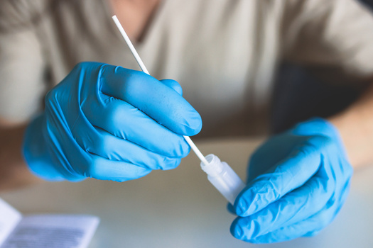 A temporary intellectual property waiver gave countries around the world better access to COVID-19 vaccines, but did not extend to treatments and tests. (tsuguliev/Adobe Stock)