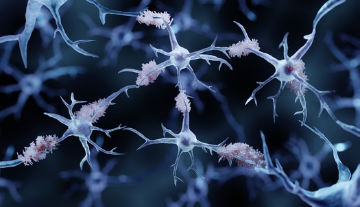 According to the Alzheimer's Association, 6.5 million Americans age 65 and older are living with Alzheimer's in 2022. Around 73% are age 75 or older. (Adobe Stock)
