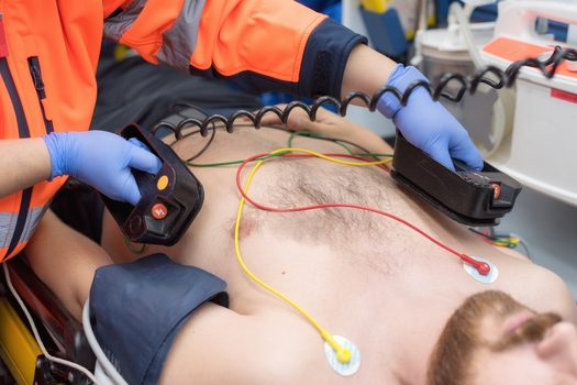 The CDC recommends schools, businesses and public gathering places keep an artificial external defibrillator available. (Adobe Stock)