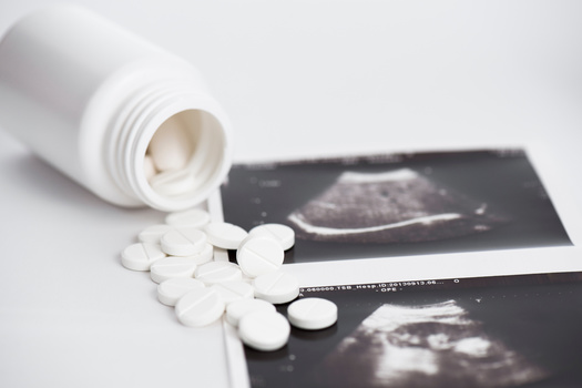 Peer-reviewed research on the use of misoprostol alone for abortion, published this month by the University of Texas at Austin, found it was 88% effective, with few serious adverse events or signs of complications. (ivanko80/AdobeStock)