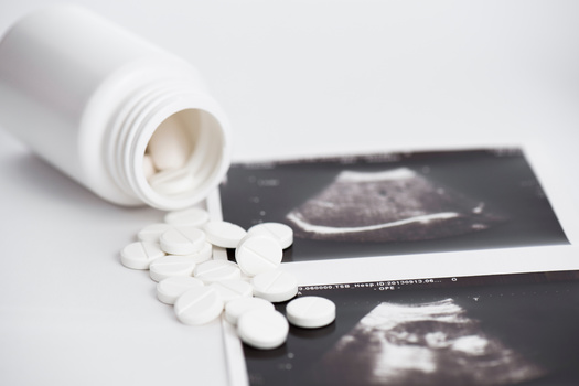 Peer-reviewed research on the use of misoprostol alone for abortion, published this month by the University of Texas at Austin, found it was 88% effective, with few serious adverse events or signs of complications. (ivanko80/AdobeStock)