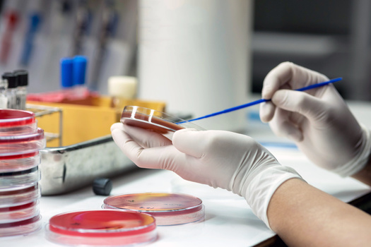 According to Centers for Disease Control and Prevention, every 15 minutes a person in the United States dies from an infection resistant to treatment with existing antimicrobial drugs. (Adobe Stock)