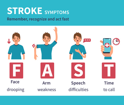 Stroke is ranked as the second leading cause of death worldwide, with an annual mortality rate of about 5.5 million people. (Irina Strelnikova/Adobe Stock)