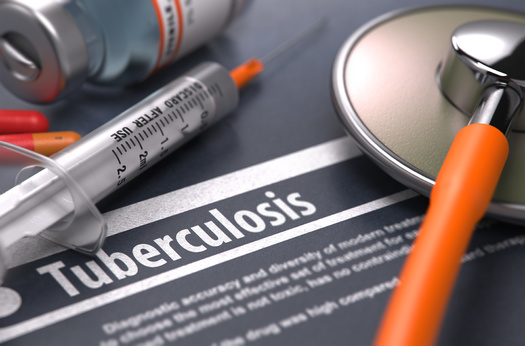 Researchers at the University of Montana are working on a vaccine for tuberculosis. While considered a serious problem in underdeveloped parts of the world, cases in the United States are up, having jumped to 8,300 in 2022 from 7,874 in 2021. (Adobe Stock)