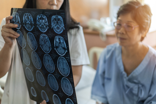 Artificial intelligence has recently been used to facilitate the diagnosis of acute stroke, by automatically detecting intracranial hemorrhage on noncontrast computed tomography scans of the head. (Adobe Stock) 