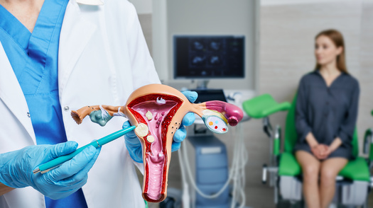 Fibroid Awareness Month is observed in July, with the goal of improving access to care and research funding. (Peakstock/Adobe Stock)