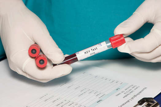 People with HIV who know their status, take HIV medicine as prescribed, and get and keep an undetectable viral load can live long and healthy lives. (Adobe Stock) 