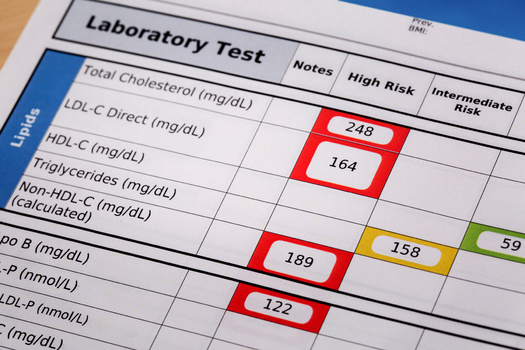 A blood test is the only way to determine your cholesterol levels. (jarun011/Adobe Stock)