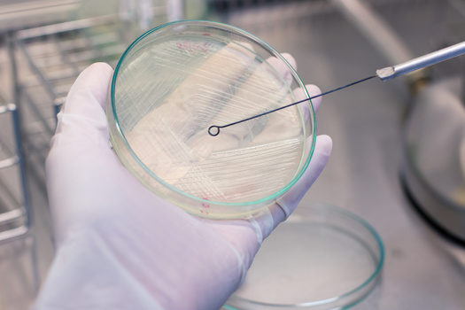 The process for testing for bacteria in foods can be a tricky, segmented process. (sinhyu/Adobe Stock)
