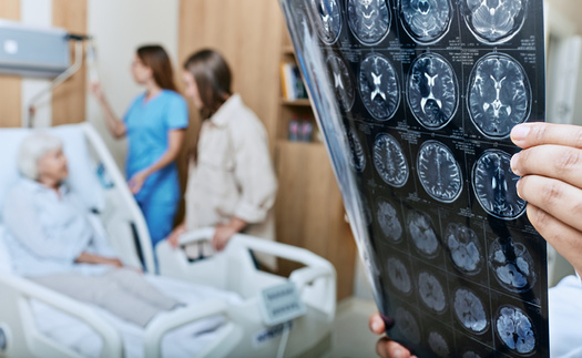 Despite care gaps, health experts with the American Heart Association say in Minnesota, every resident is within 30 minutes of a hospital able to provide stroke care. (Adobbe Stock)