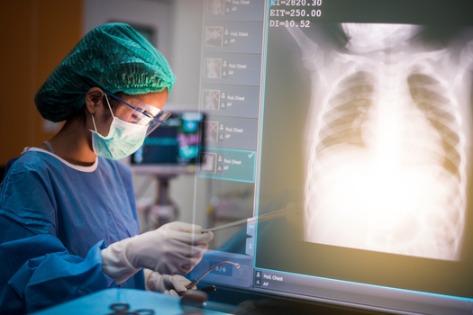 Kentucky ranks 48 of 50 in the nation for rate of new lung cancer cases at 84.8 per 100,000. The national rate is 54.6 per 100,000, according to the American Lung Association. (Adobe Stock)