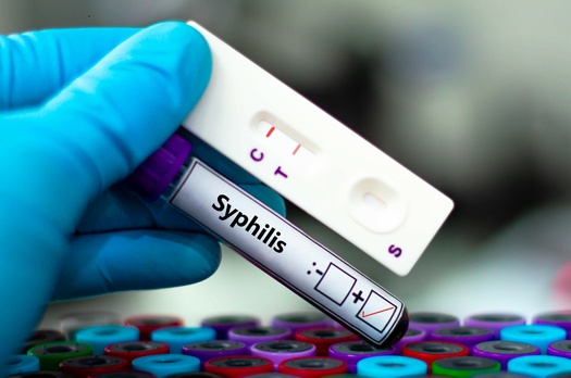 According to the Great Plains Tribal Epidemiology Center, one in 40 Native American and Alaska Native babies born in the Great Plains region in 2022 had a syphilis infection. (Adobe Stock)