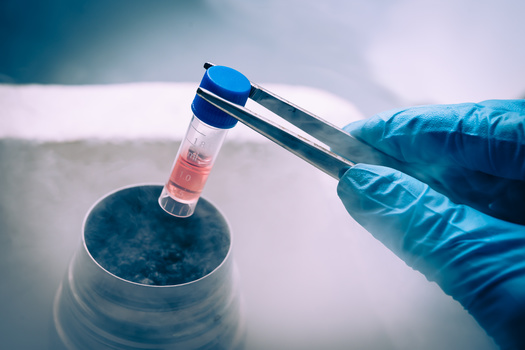 Stem cells are the building blocks for all of the body's organs and tissues. Scientists estimate that a human has between 300 million and 1 billion at birth. (Adobe Stock) 