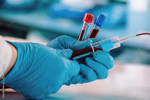 A 2021 U.S. Government Accountability Office study estimated there are 7,000 to 8,000 ailments recognized as rare diseases that affect around 30 million people in the United States. (Adobe Stock)