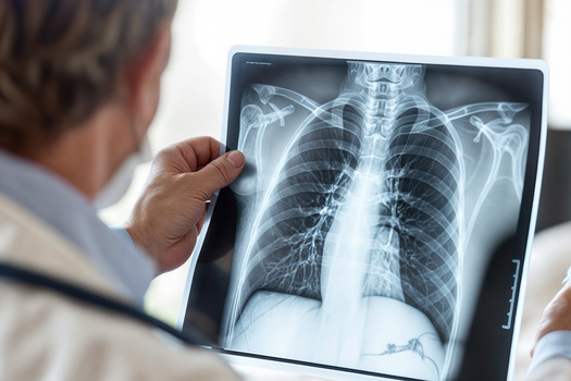 According to the American Journal for Public Health, in the 1980s, the National Institute for Occupational Safety and Health led pioneering research on job-related musculoskeletal injuries, workplace violence, latex allergy among health care workers and risks of occupational exposures to blood-borne pathogens. (Adobe Stock)