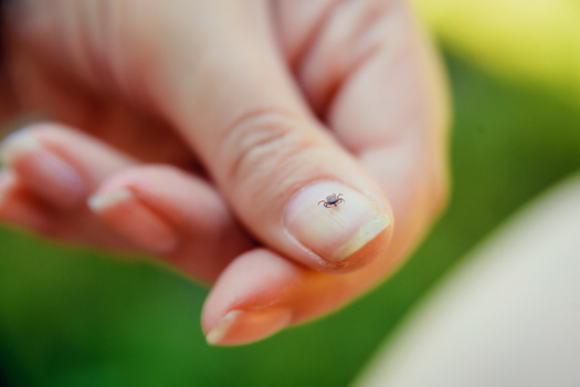 Health experts said if you spot a tick on your body, you need to remove it immediately to avoid getting infected with Lyme disease or something similar. Using tweezers is strongly recommended in the removal process. (Adobe Stock)