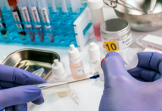 The national organization RAINN says DNA evidence is a critical factor in achieving justice for survivors of sexual violence, but there are still challenges in the way evidence is collected, stored, tracked and used to hold perpetrators accountable. (Adobe Stock)