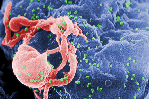 IMAGE: Scanning electron micrograph of HIV-1. Credit: Cynthia Goldsmith, Centers for Disease Control and Prevention.
