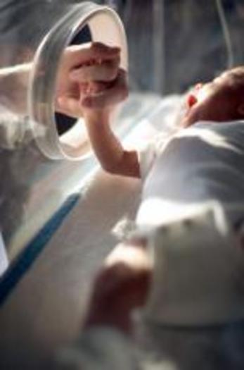 Photo: NIH-funded neonatal studies are under new scrutiny. Photo credit: NLM.NIH.GOV