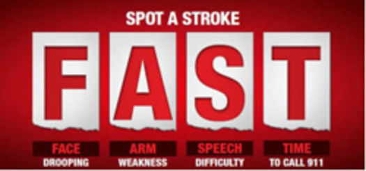 IMAGE: Time is vital for treating a stroke, as brain damage mounts with each passing minute and there is a short time frame in which clot-busting drugs can be administered. Credit: American Heart Assn.