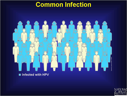 At least 70 percent of sexually active persons will be infected with genital HPV at some time in their lives. Courtesy of: National Cancer Institute