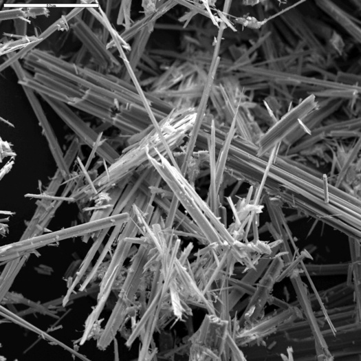 PHOTO: A microscopic view of asbestos fibers. The Iowa DNR says it's common to uncover asbestos during remodeling projects. Photo credit: USGS