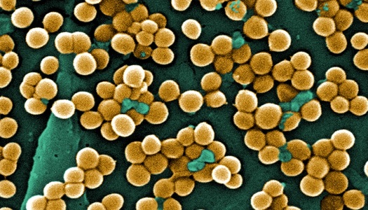 PHOTO: Antibiotics save lives, but medical experts say their overuse has led to the development of resistant bacteria, making antibiotics ineffective in treating certain conditions. Photo: antibiotic-resistant Staphylococcus aureus (MRSA bacteria). Credit: Public Health Image Library.