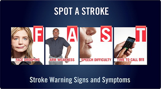 GRAPHIC: The symptoms of a stroke can be easily remembered with the acronym FAST. Courtesy American Heart Association of Minnesota.