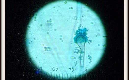 PHOTO: People with weakened immune systems or lung diseases are at a higher risk of developing health problems from Aspergillus (as seen via microscope above), a common mold that lives both indoors and outdoors. Photo credit: Iqbal Osman/Flickr.