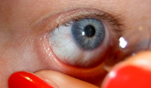 Contact lens wearers need good hygiene habits to avoid bacteria that can blind a person. Credit: J Durham/Morguefile
