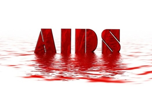 About 22,000 Ohioans are currently living with HIV. (Pixabay)