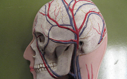 Strokes are among the leading causes of long-term disability in the United States. (GreenFlames09/Flickr)